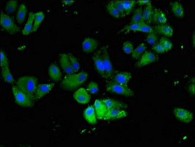 Immunocytochemistry/ Immunofluorescence - Anti-FAM111A antibody (AB234868), expandable thumbnail