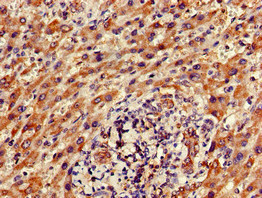 Immunohistochemistry (Formalin/PFA-fixed paraffin-embedded sections) - Anti-FAM111A antibody (AB234868), expandable thumbnail