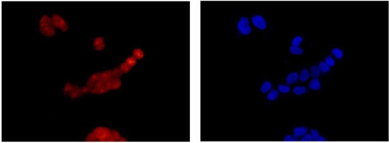 Immunocytochemistry/ Immunofluorescence - Anti-FAM111A antibody [EPR14407] (AB184572)