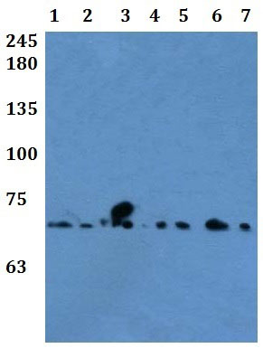Western blot - Anti-FAM111A antibody - N-terminal (AB200718)