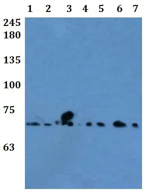 Western blot - Anti-FAM111A antibody - N-terminal (AB200718)