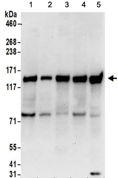 Western blot - Anti-FAM120A/OSSA antibody (AB156695)