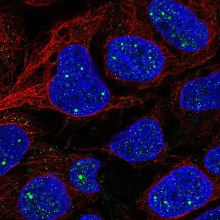 Immunocytochemistry/ Immunofluorescence - Anti-FAM123B antibody (AB221578)