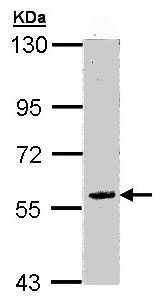 Western blot - Anti-FAM126A antibody (AB98144), expandable thumbnail