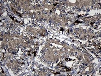 Immunohistochemistry (Formalin/PFA-fixed paraffin-embedded sections) - Anti-FAM131C antibody [OTI6E2] (AB236383)