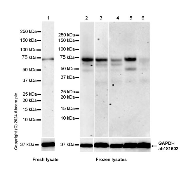 Western blot - Anti-FAM134B antibody [EPR28817-67] (AB316161), expandable thumbnail