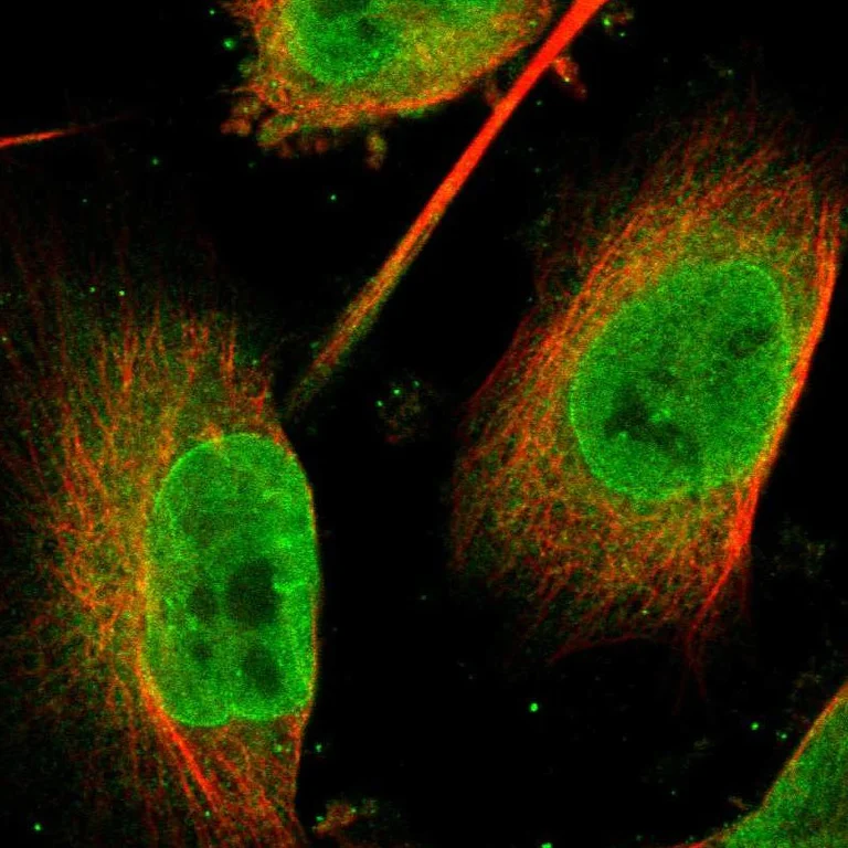 Immunocytochemistry/ Immunofluorescence - Anti-FAM134C antibody (AB246913)