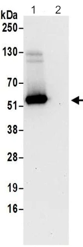 Immunoprecipitation - Anti-FAM134C antibody - C-terminal (AB202125)