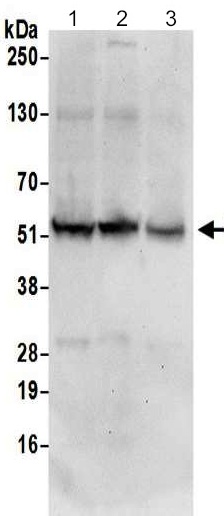 Western blot - Anti-FAM134C antibody - C-terminal (AB202125)