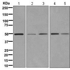 Western blot - Anti-FAM134C antibody [EPR11765] (AB171079), expandable thumbnail