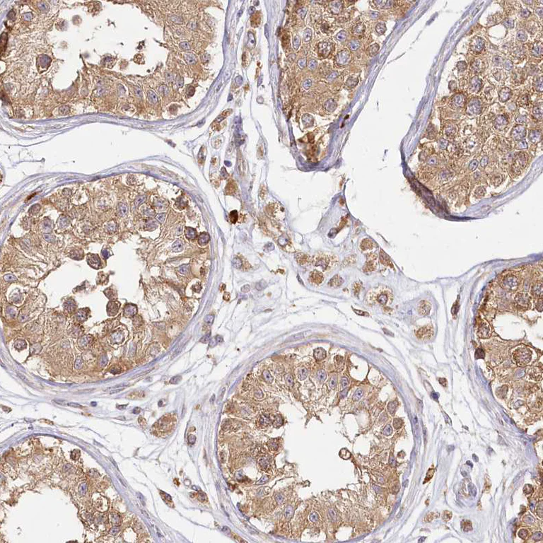 Immunohistochemistry (Formalin/PFA-fixed paraffin-embedded sections) - Anti-FAM13A antibody (AB122440)