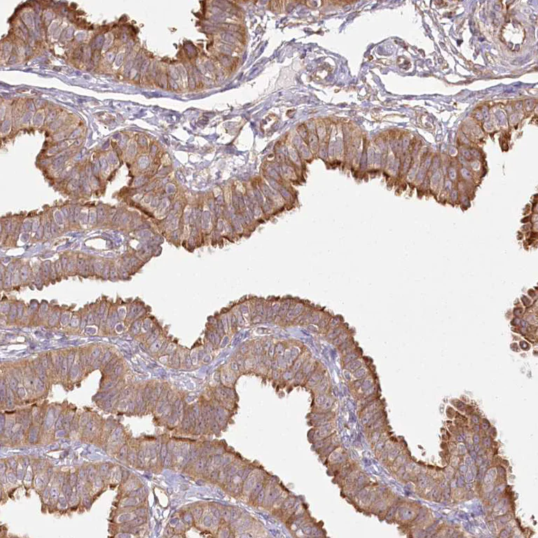 Immunohistochemistry (Formalin/PFA-fixed paraffin-embedded sections) - Anti-FAM13A antibody (AB122440)