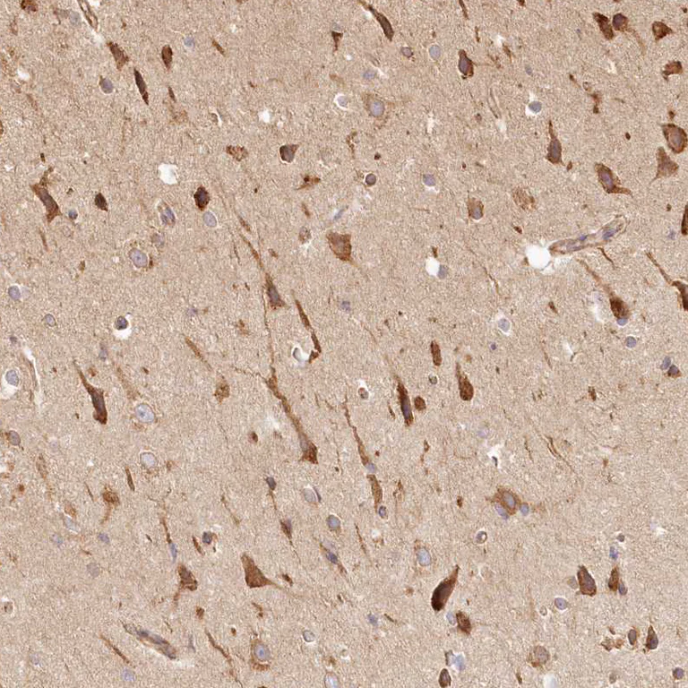 Immunohistochemistry (Formalin/PFA-fixed paraffin-embedded sections) - Anti-FAM13A antibody (AB122440)