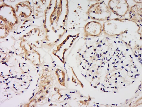 Immunohistochemistry (Formalin/PFA-fixed paraffin-embedded sections) - Anti-FAM149B1 antibody (AB214177)