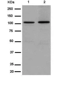 Western blot - Anti-FAM160A2 antibody [EPR13604] (AB184160)