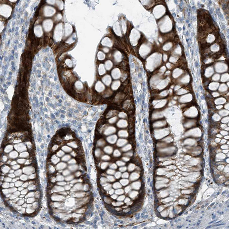 Immunohistochemistry (Formalin/PFA-fixed paraffin-embedded sections) - Anti-FAM162A antibody (AB122295)