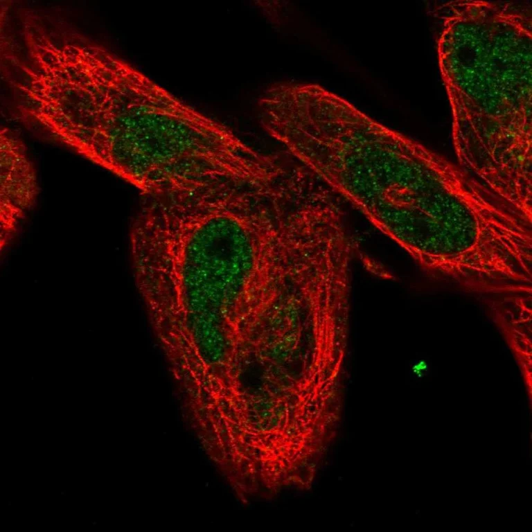 Immunocytochemistry/ Immunofluorescence - Anti-FAM168A antibody (AB254815)