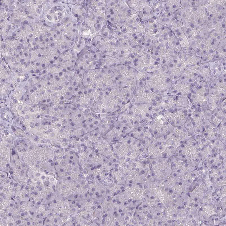 Immunohistochemistry (Formalin/PFA-fixed paraffin-embedded sections) - Anti-FAM168A antibody (AB254815)