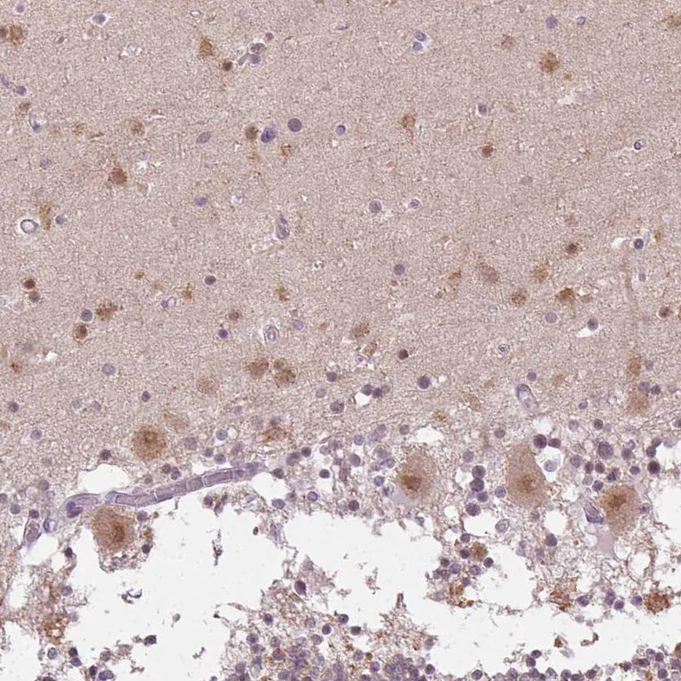 Immunohistochemistry (Formalin/PFA-fixed paraffin-embedded sections) - Anti-FAM168A antibody (AB254815)