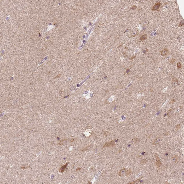 Immunohistochemistry (Formalin/PFA-fixed paraffin-embedded sections) - Anti-FAM168A antibody (AB254815)