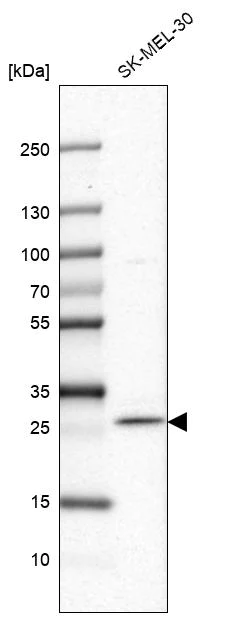 Western blot - Anti-FAM168A antibody (AB254815)