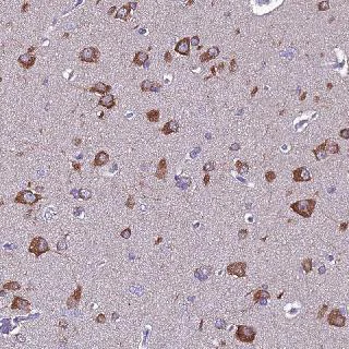 Immunohistochemistry (Formalin/PFA-fixed paraffin-embedded sections) - Anti-FAM173A antibody (AB126340)
