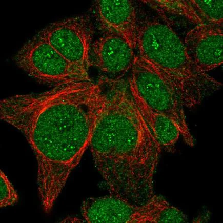Immunocytochemistry/ Immunofluorescence - Anti-FAM198B antibody (AB224234)