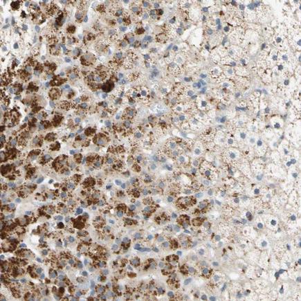 Immunohistochemistry (Formalin/PFA-fixed paraffin-embedded sections) - Anti-FAM198B antibody (AB224234)