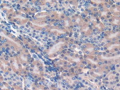 Immunohistochemistry (Formalin/PFA-fixed paraffin-embedded sections) - Anti-FAM19A2 antibody (AB231186)