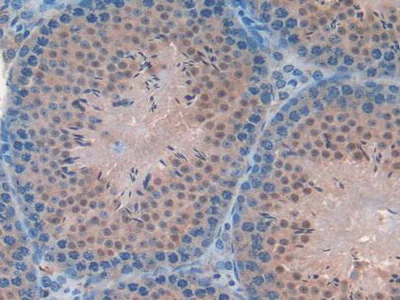Immunohistochemistry (Formalin/PFA-fixed paraffin-embedded sections) - Anti-FAM19A2 antibody (AB231186)