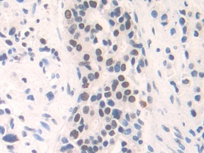 Immunohistochemistry (Formalin/PFA-fixed paraffin-embedded sections) - Anti-FAM19A3/TAFA3 antibody (AB231207)