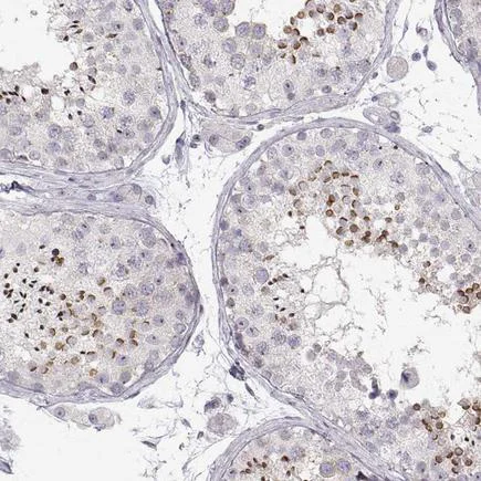 Immunohistochemistry (Formalin/PFA-fixed paraffin-embedded sections) - Anti-FAM205A antibody - C-terminal (AB222189)