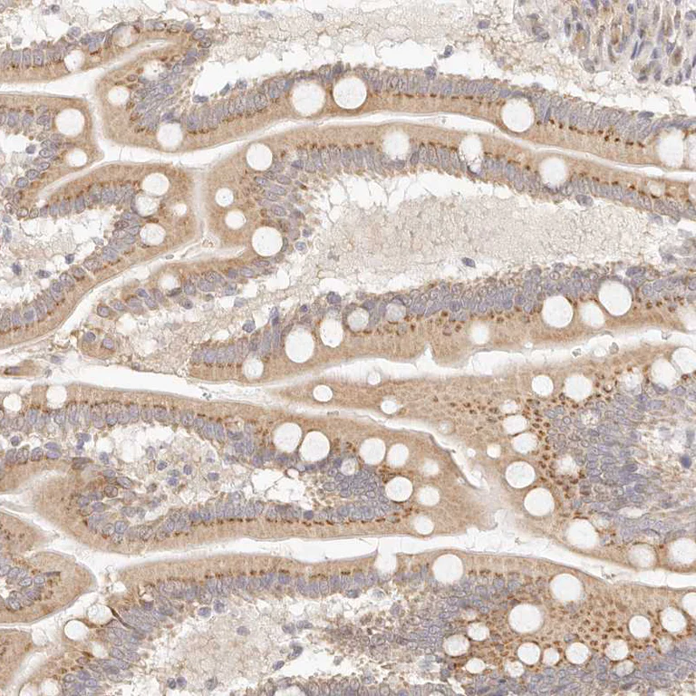 Immunohistochemistry (Formalin/PFA-fixed paraffin-embedded sections) - Anti-FAM20B antibody (AB121261)