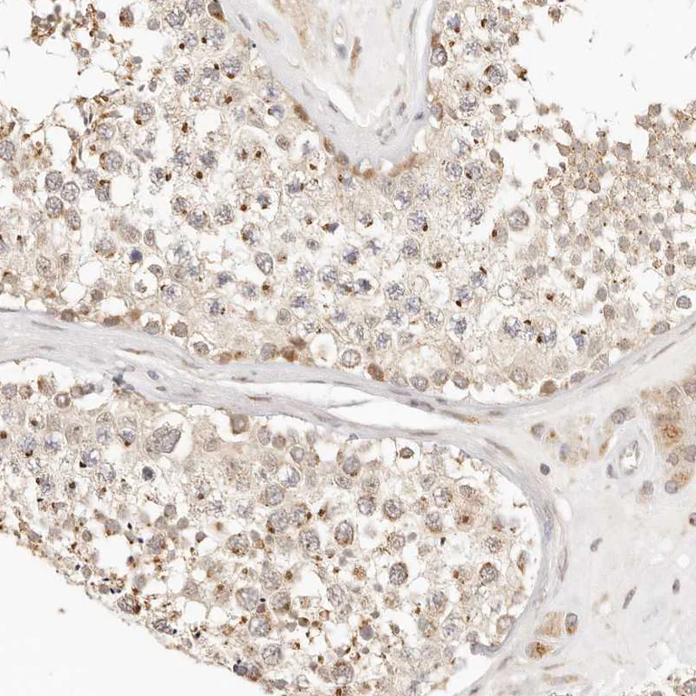 Immunohistochemistry (Formalin/PFA-fixed paraffin-embedded sections) - Anti-FAM20B antibody (AB121261)