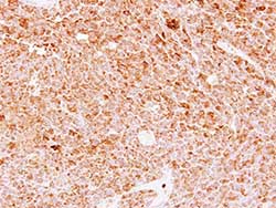 Immunohistochemistry (Formalin/PFA-fixed paraffin-embedded sections) - Anti-FAM20C antibody (AB154740), expandable thumbnail