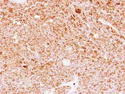 Immunohistochemistry (Formalin/PFA-fixed paraffin-embedded sections) - Anti-FAM20C antibody (AB154740)