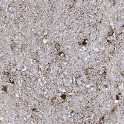 Immunohistochemistry (Formalin/PFA-fixed paraffin-embedded sections) - Anti-FAM210A antibody (AB150789)