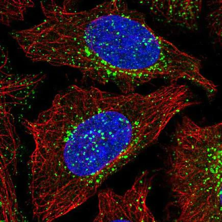 Immunocytochemistry/ Immunofluorescence - Anti-FAM21B antibody (AB220970)
