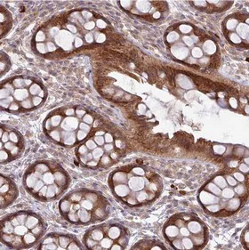 Immunohistochemistry (Formalin/PFA-fixed paraffin-embedded sections) - Anti-FAM222B antibody (AB151147)