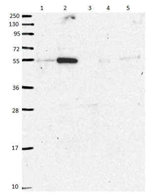 Western blot - Anti-FAM222B antibody (AB151147)