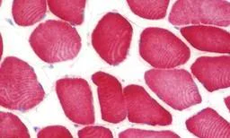 Immunohistochemistry (Formalin/PFA-fixed paraffin-embedded sections) - Anti-FAM26F antibody - C-terminal (AB194946)