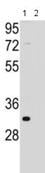 Western blot - Anti-FAM26F antibody - C-terminal (AB194946)