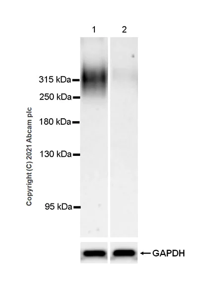 Western blot - Anti-FAM38A/PIEZO1 antibody [EPR23826-103] (AB259949)