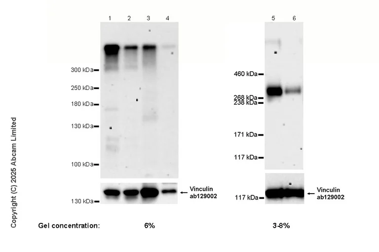 Western blot - Anti-FAM38A/PIEZO1 antibody [EPR30472-532] - BSA and Azide free (AB326598)
