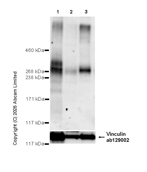 Western blot - Anti-FAM38A/PIEZO1 antibody [EPR30472-532] - BSA and Azide free (AB326598)
