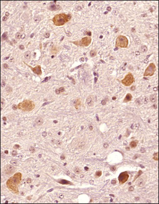 Immunohistochemistry (Formalin/PFA-fixed paraffin-embedded sections) - Anti-FAM3C/ILEI antibody (AB72182), expandable thumbnail