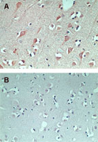 Immunohistochemistry (Formalin/PFA-fixed paraffin-embedded sections) - Anti-FAM3C/ILEI antibody (AB72182), expandable thumbnail