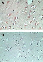 Immunohistochemistry (Formalin/PFA-fixed paraffin-embedded sections) - Anti-FAM3C/ILEI antibody (AB72182)