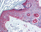 Immunohistochemistry (Formalin/PFA-fixed paraffin-embedded sections) - Anti-FAM3C/ILEI antibody (AB72182), expandable thumbnail