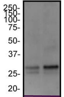 Western blot - Anti-FAM3C/ILEI antibody (AB72182), expandable thumbnail